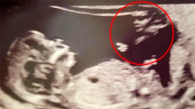 bebek-ultrason.jpg