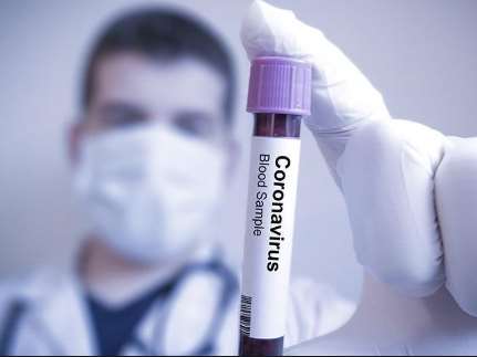 coronavirus-olu-sayisi-siyasetcafe.jpg